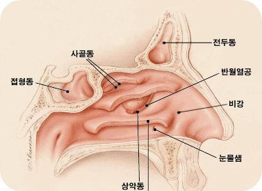 축농증-원인