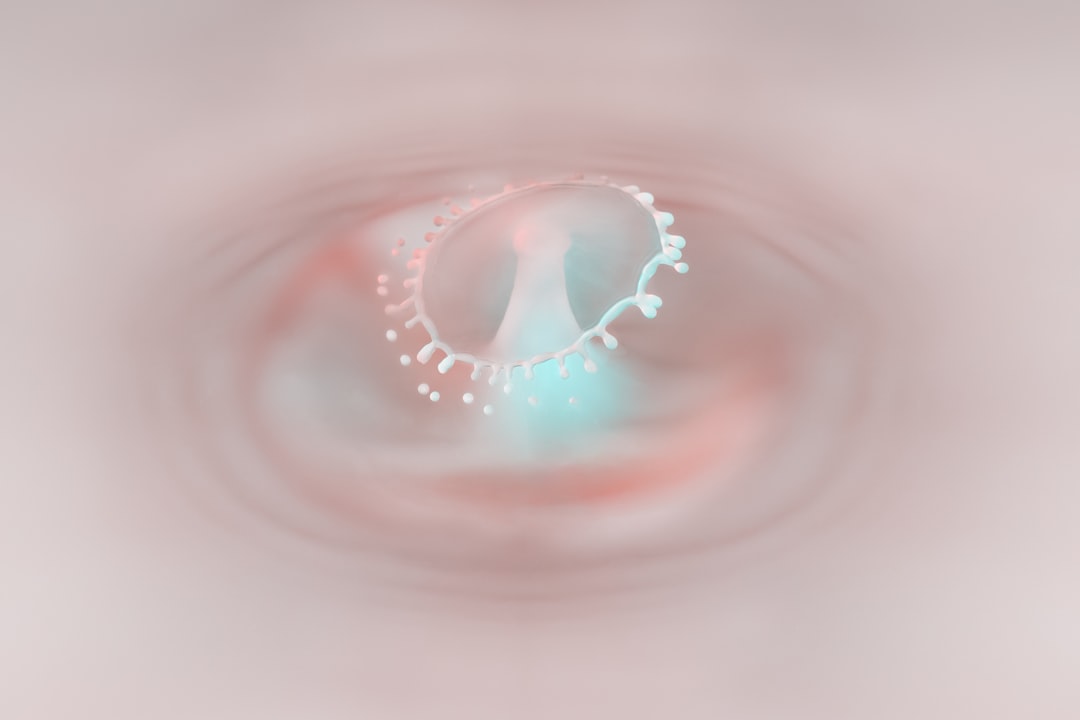 Cataract
