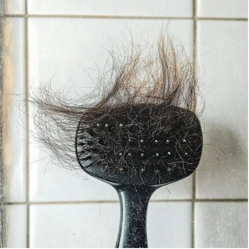 양모모발증후군 관리법 엉킨머리