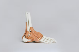 발뒤꿈치 통증, 발뒤꿈치가 아픈 이유, 원인 및 치료방법