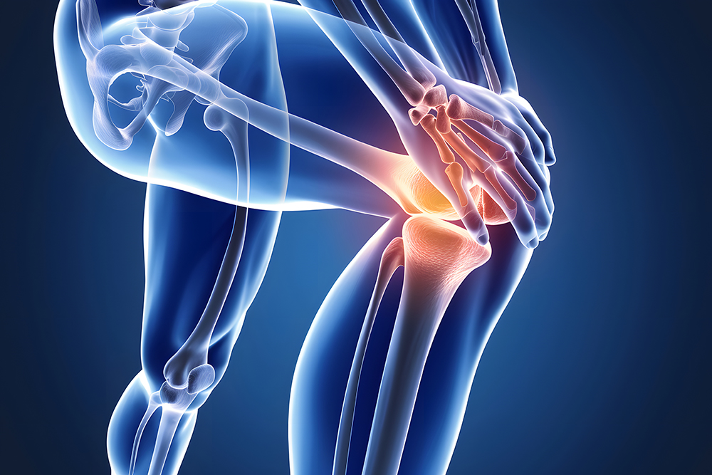 관절에 좋은 음식