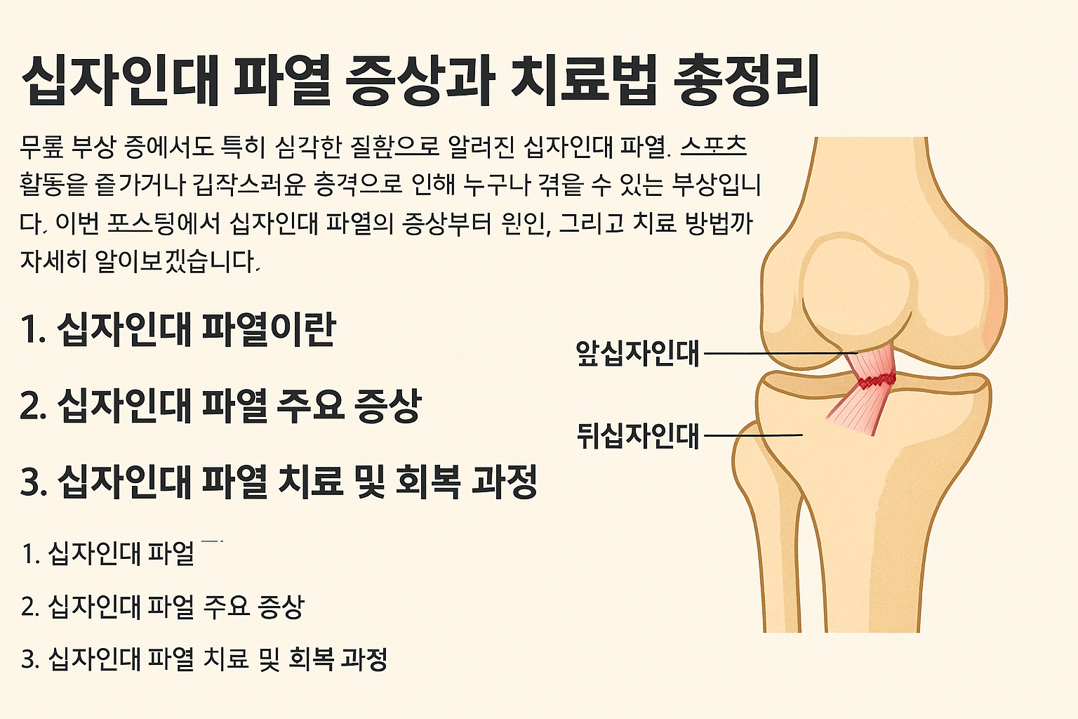 십자인대 파열에 관한 사진