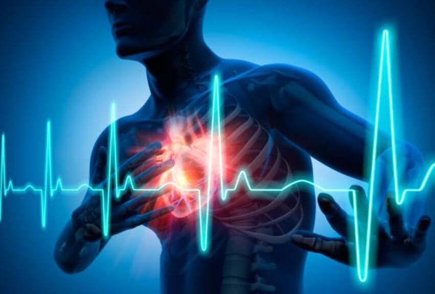 심장마비 전조증상