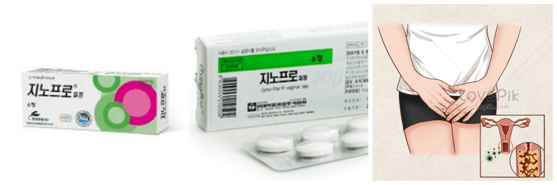 지노프로 질정, 질염 사진