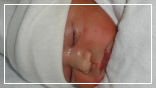 코로나19 예방접종_87