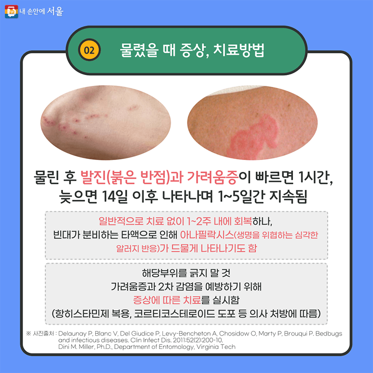 출처-서울시 내손안에 서울-빈대퇴치제-빈대물린자국-베드버그예방