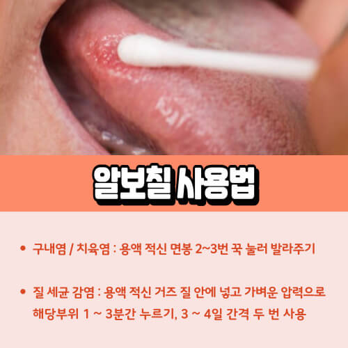 알보칠_사용법