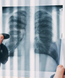 가운데 가슴 통증 원인과 자가진단|언제 병원 가야 할지 바로 확인!