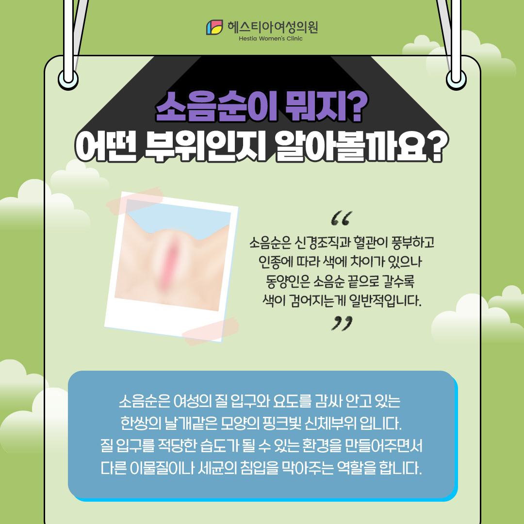 소음순이 뭐지?