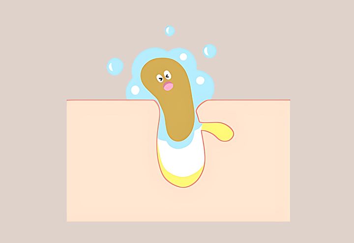 과도한-피부-기름과-피지의-모습