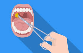 목에 이물감 느껴지는 증상
