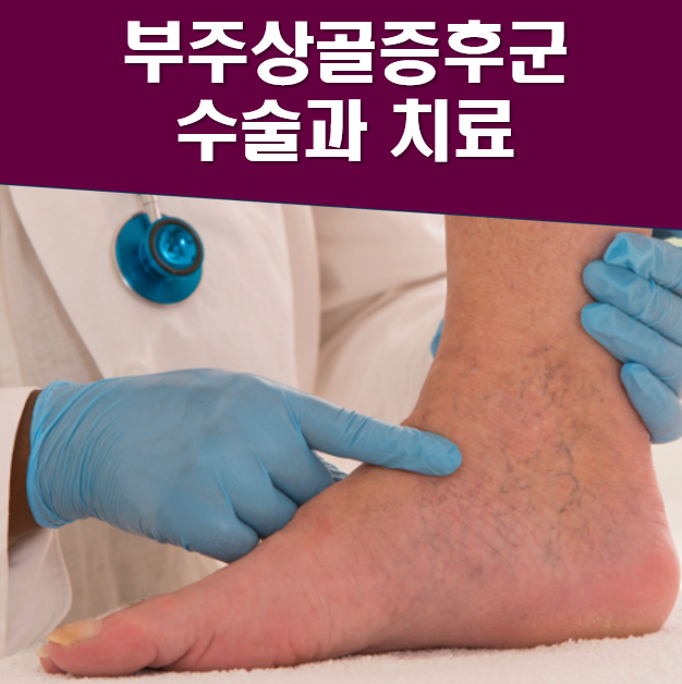 부주상골 증후군 치료방법 및 수술