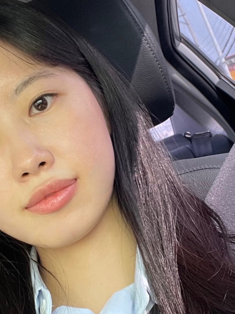 온다 리프팅 후기