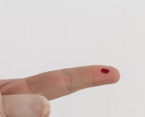 간수치가 높으면 나타나는 증상 35