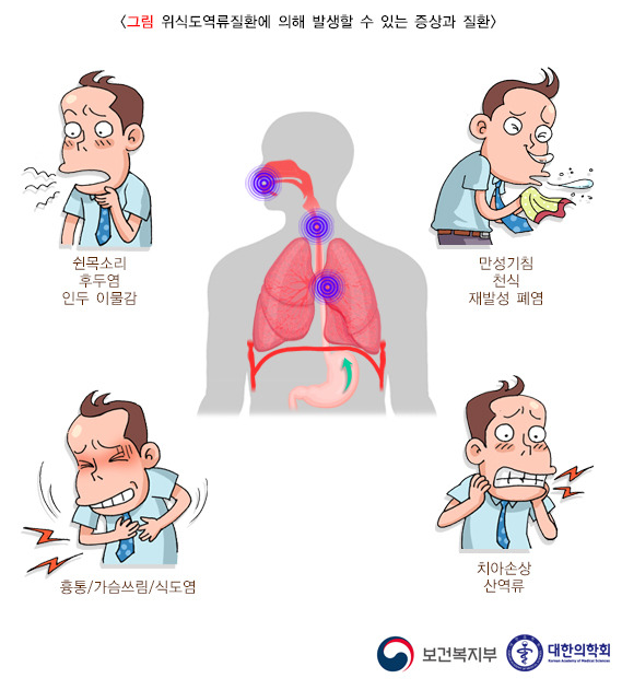 위식도 역류 질환의 원인과 증상, 진단, 치료와 예방 방법, 합병증