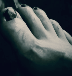 발저림 원인 증상&amp;#44; 치료법과 병원 선택까지