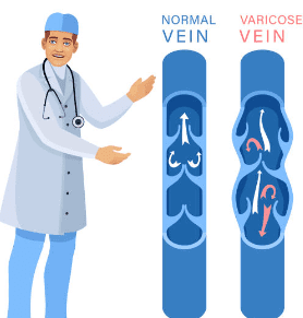 하지 정맥류 증상 수술비용