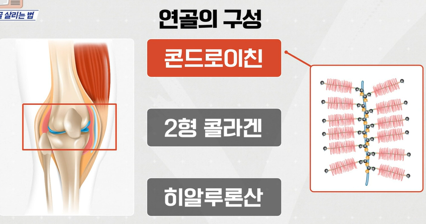 콘드로이친