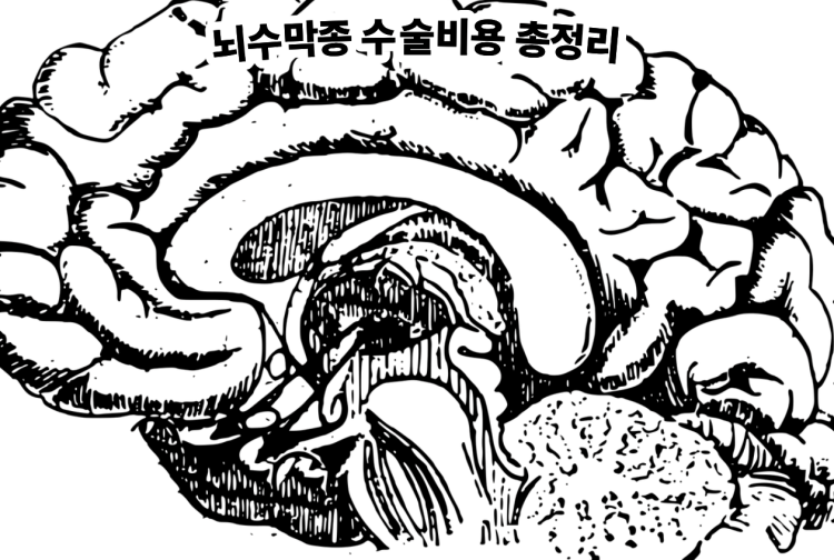 뇌수막종 수술비용 총정리