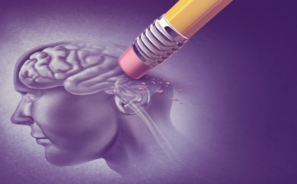 알츠하이머·파킨슨·혈관성 치매 차이점 총정리 + 증상 체크리스트