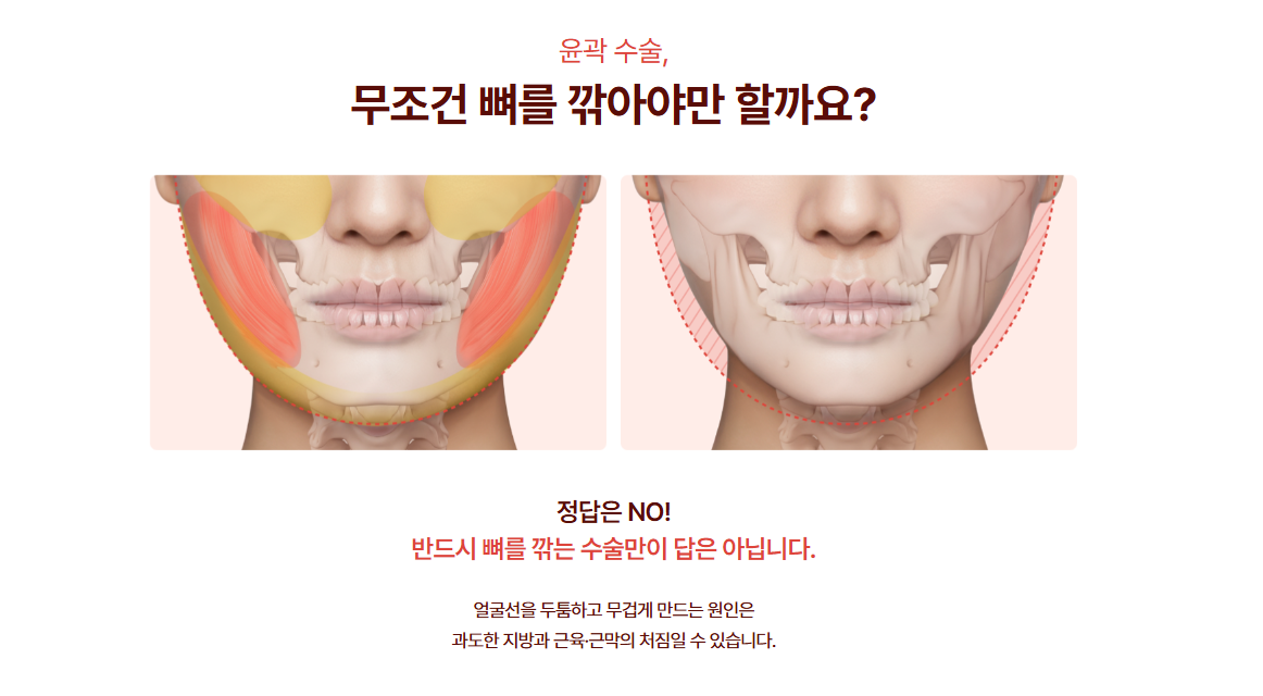 신사역리프팅성형외과 미니윤곽술