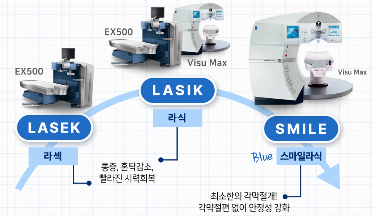 스마일라식 기계 사진