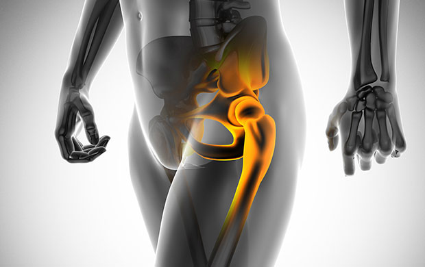 고관절 통증 증상