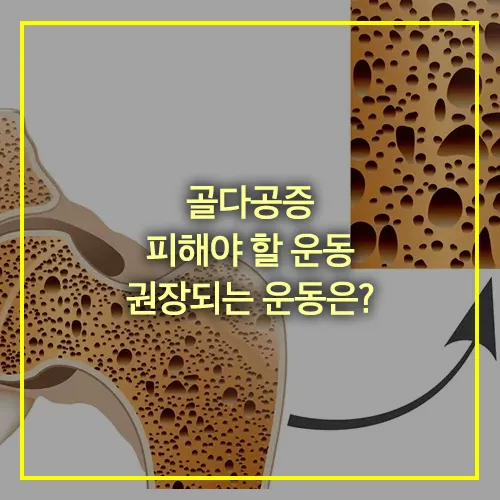 골다공증 운동