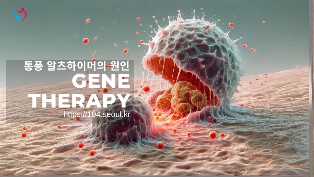 통풍 알츠하이머의 원인? 자기성분 이 발단이 되는 경악스러운 사실