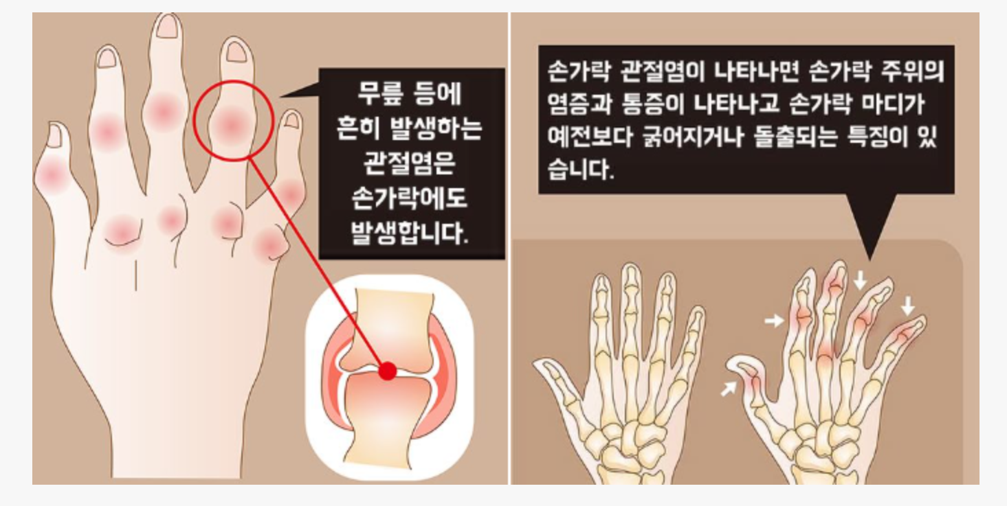 생활 속 예방법과 루틴