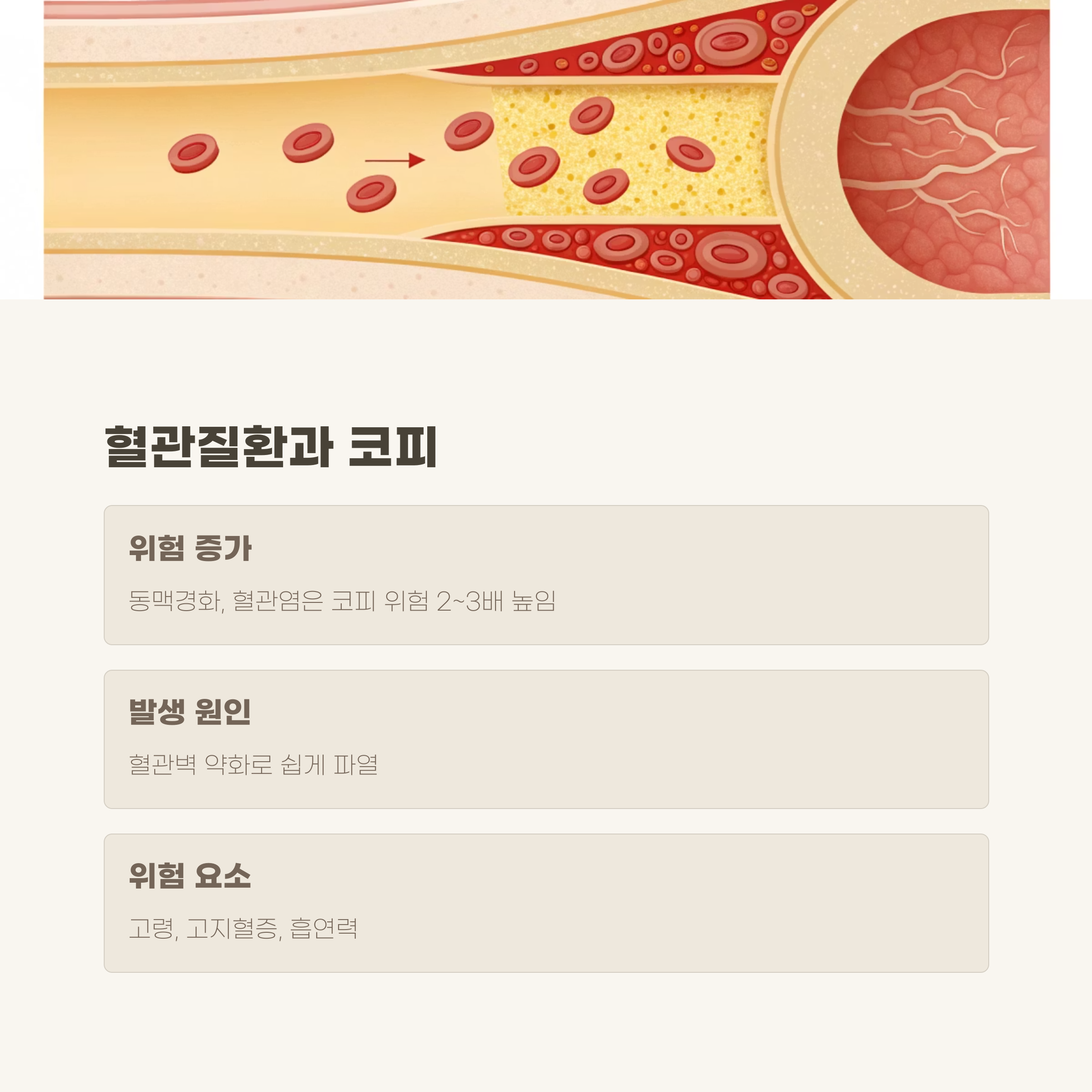 혈관질환: 고혈압과 함께 혈관염 또는 동맥경화증 확인 필요