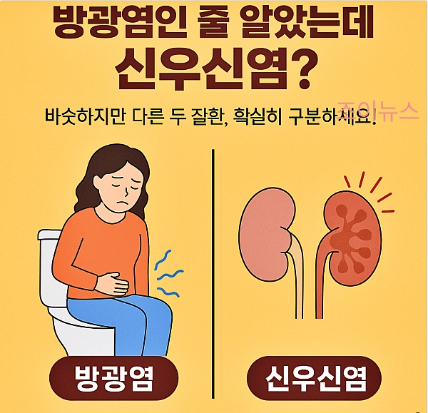 방광염과 신우신염의 차이, 확실히 구분하세요!!