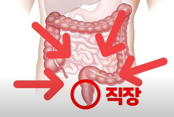 식사 후 S장에 압력증가