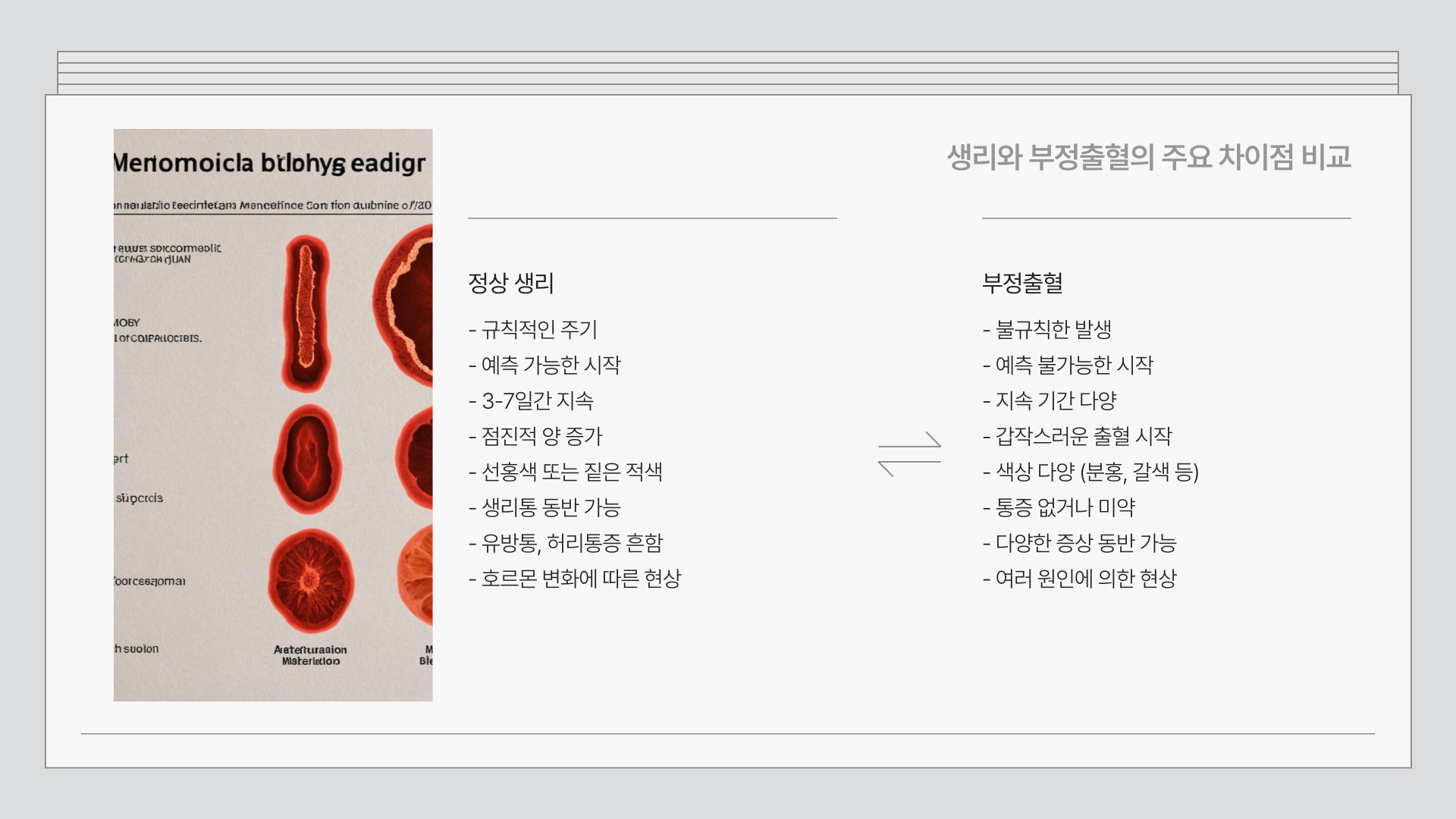 부정출혈과 생리 차이