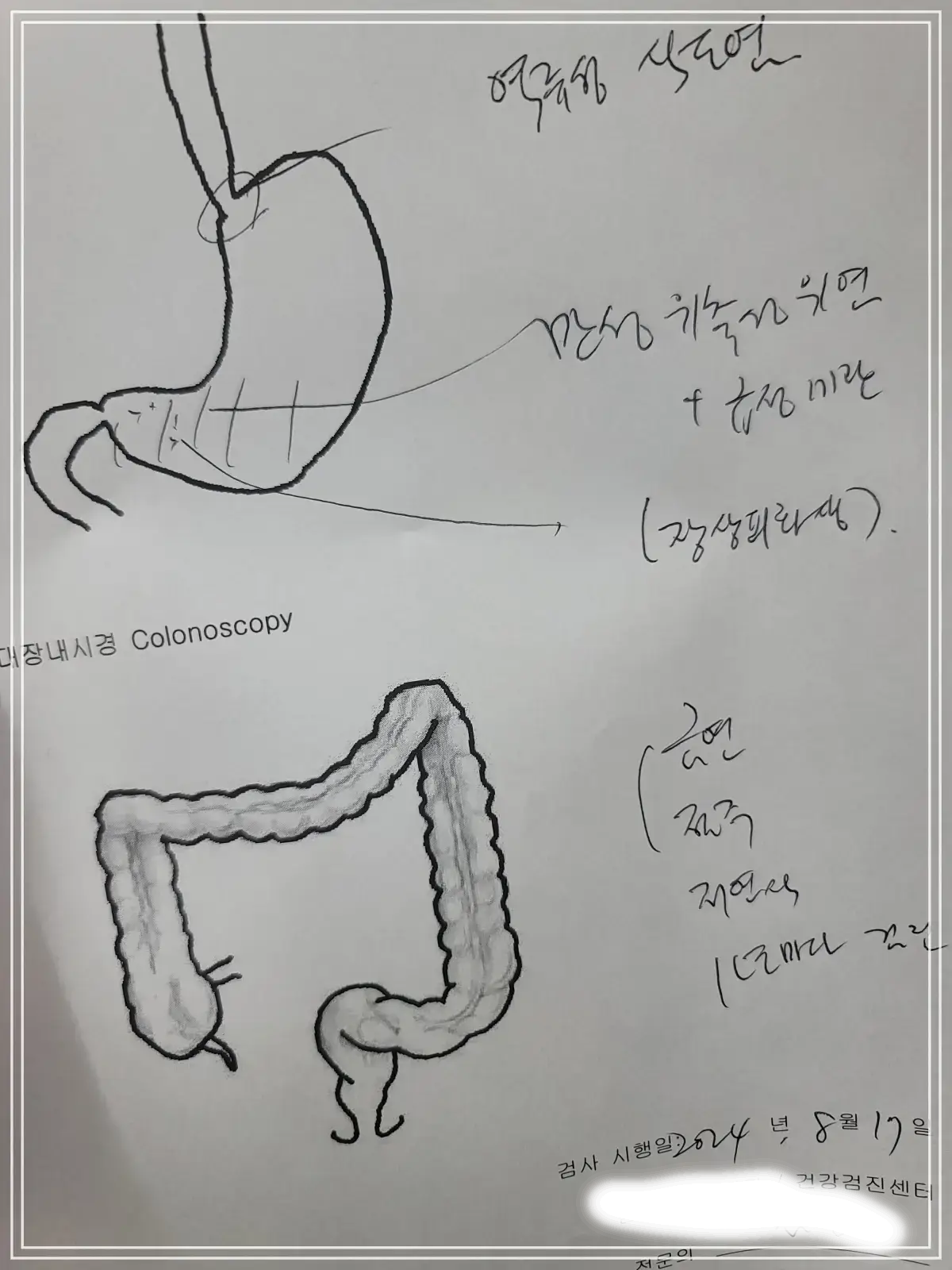 위-내시경-결과-진료