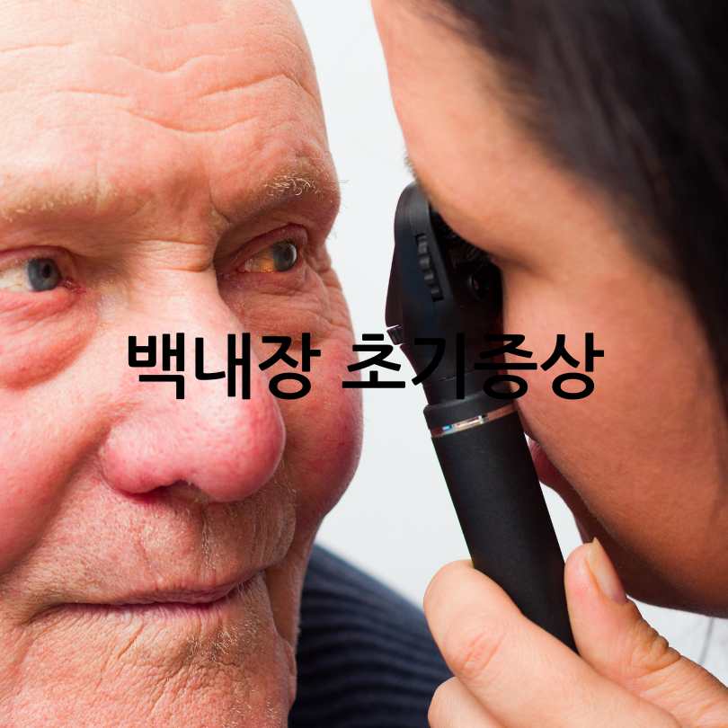백내장 초기증상