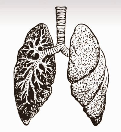 폐섬유화 증상과 원인, 초기 치료법은?