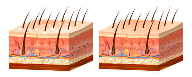 하나의 원인으로 설명되지 않는 두피 트러블의 특징 정리