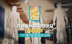 가려움증