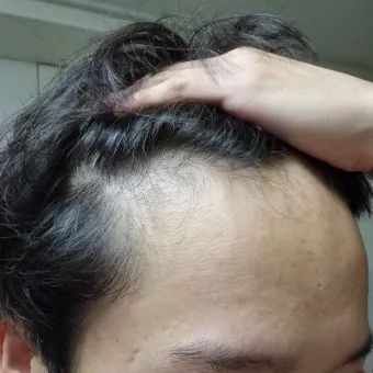 이마가 넓은 여자 관상 특징과 해석_17