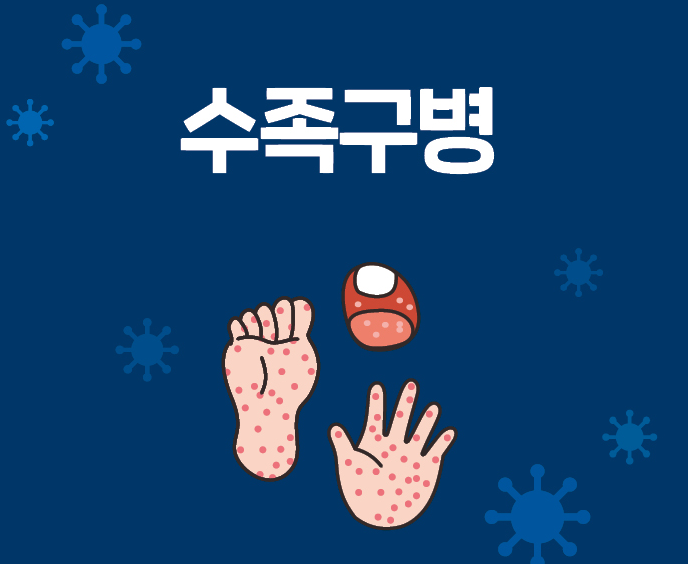 수족구병