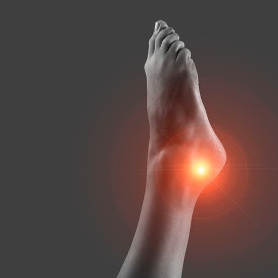 족근관 증후군 (Tarsal Tunnel Syndrome) - 원인, 증상 및 치료법