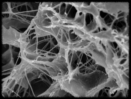 콜라겐과 치매: 두 가지의 숨겨진 연관성