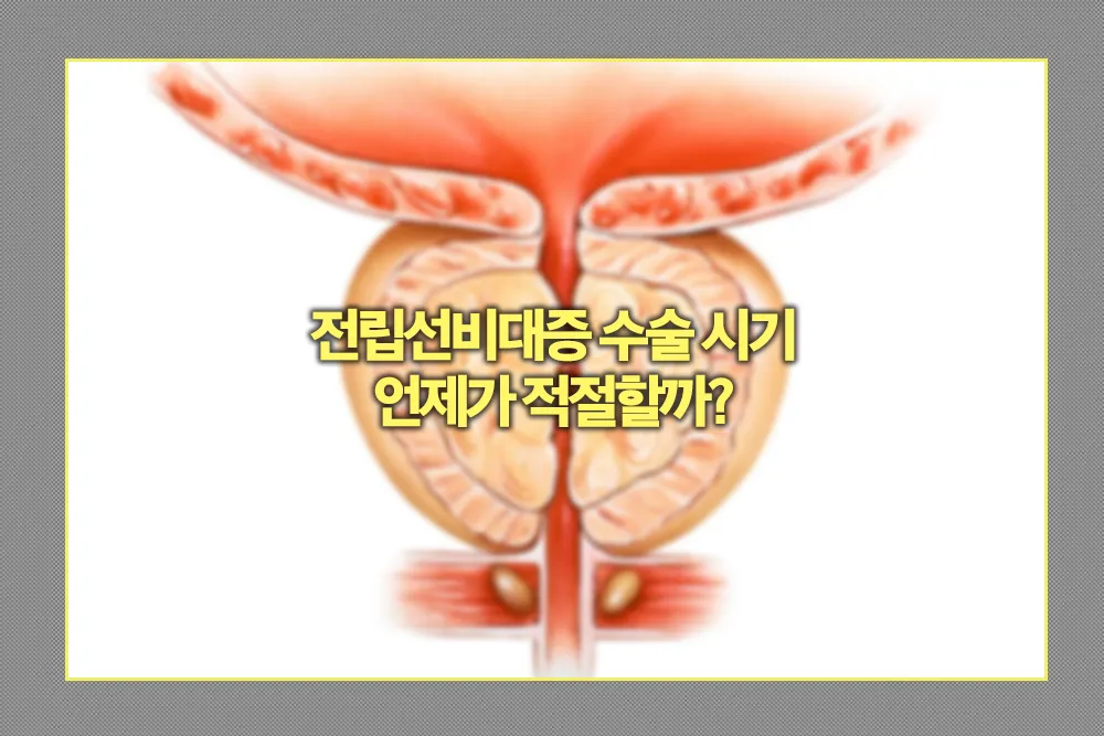 전립선비대증 적절한 수술 시기