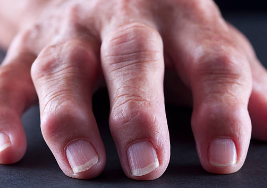손가락 마디 통증