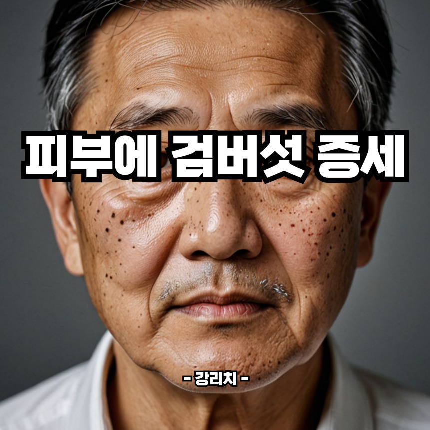 피부 검버섯 증세