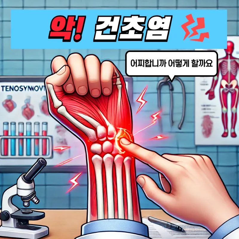 건초염