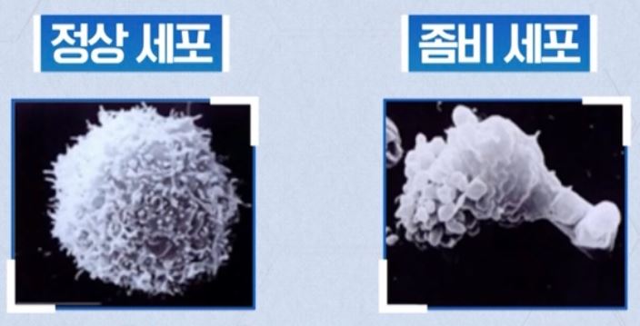 좀비세포 사진3