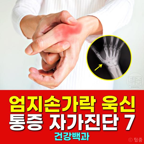 엄지손가락 관절 욱신 통증 자가진단