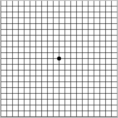 정상 시력 테스트
